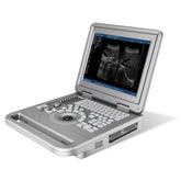 12.1 Inch Digital Ultrasound Scanner Portable with Convex Probe
