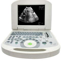 Portable Full Digital Laptop Medical Ultrasound Scanner Convex Probe