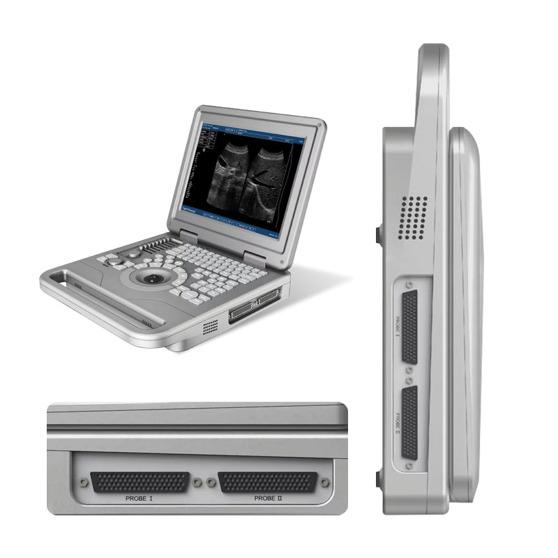 12.1 Inch Digital Ultrasound Scanner Portable with Convex Probe