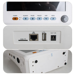 8 Inch ICU CCU Vital Sign Patient Monitor 6 parameter TFT Color ECG NIBP RESP TEMP SPO2 PR