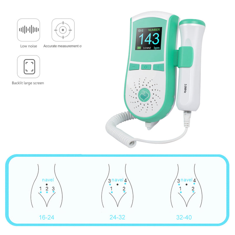 Portable Color LCD Display Pocket Fetal Doppler 3MHz
