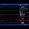 8 Inch ICU CCU Vital Sign Patient Monitor 6 parameter TFT Color ECG NIBP RESP TEMP SPO2 PR