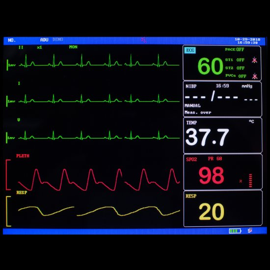 8 Inch ICU CCU Vital Sign Patient Monitor 6 parameter TFT Color ECG NIBP RESP TEMP SPO2 PR