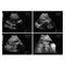 Portable Full Digital Laptop Medical Ultrasound Scanner Convex Probe