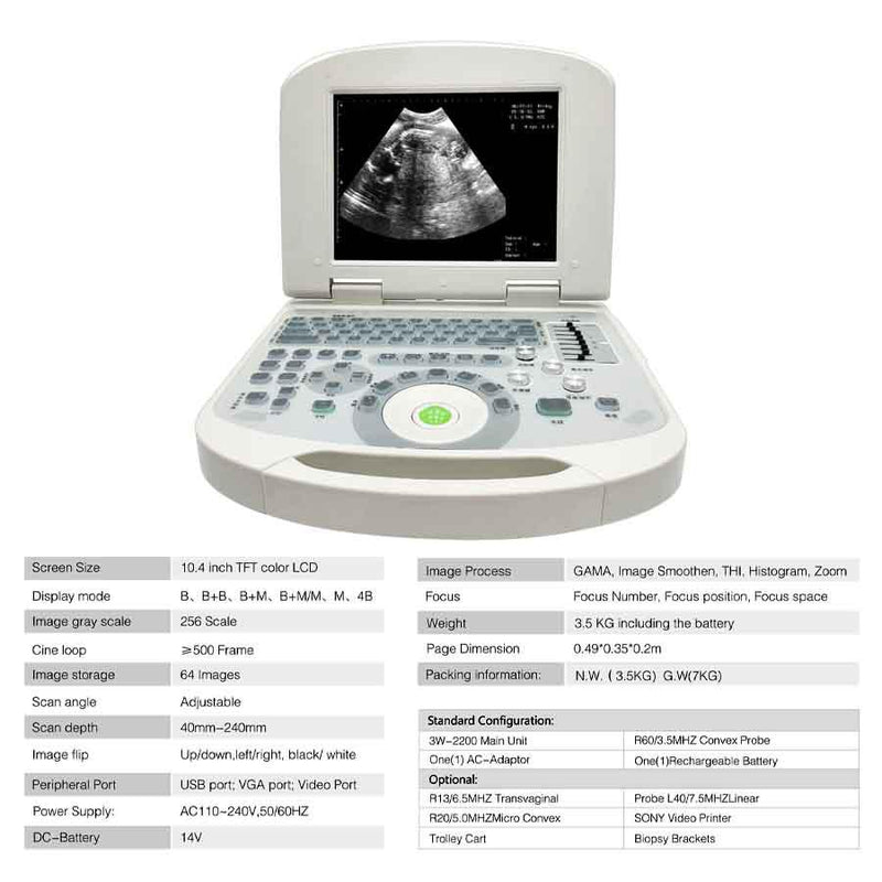 Portable Full Digital Laptop Medical Ultrasound Scanner Convex Probe