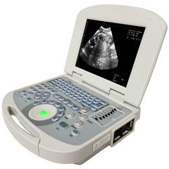 Portable Full Digital Laptop Medical Ultrasound Scanner Convex Probe